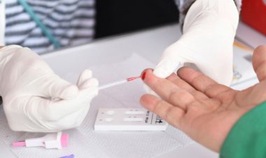 Acusan falta de dispositivos  para detectar el virus VIH