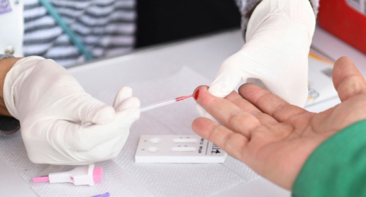 Acusan falta de dispositivos  para detectar el virus VIH