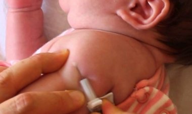 Morelos no centa con vacuna BCG para protección de recién nacidos