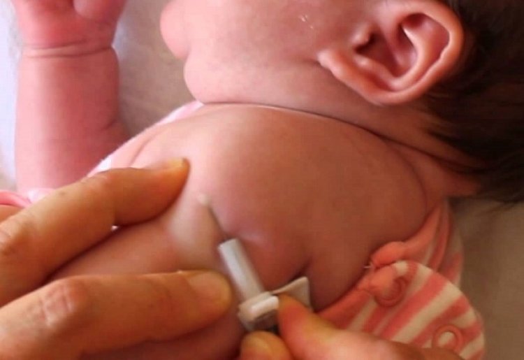 Morelos no centa con vacuna BCG para protección de recién nacidos