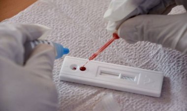 Crece número de jóvenes con males sexuales