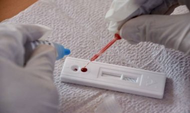 Pruebas gratuitas de VIH se están ofreciendo en Cuautla