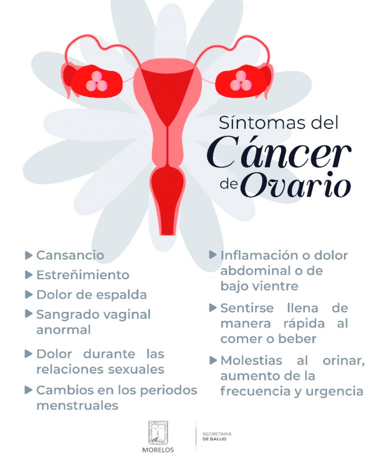 Hay medidas varias para evitar el cáncer de ovario