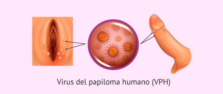 Se exhorta a vacunar a niñas  en contra de virus de papiloma