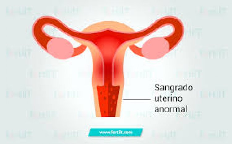 Sangrado uterino en adolescentes puede ser síntoma de una anemia