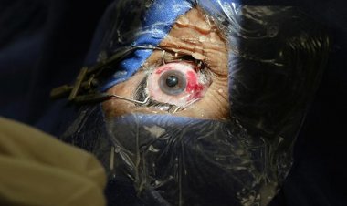 Se practicaron más de 3 mil 250  trasplantes en el IMSS en 2024