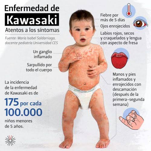 ¿Sabes si tu hijo tiene síndrome de Kawasaki?