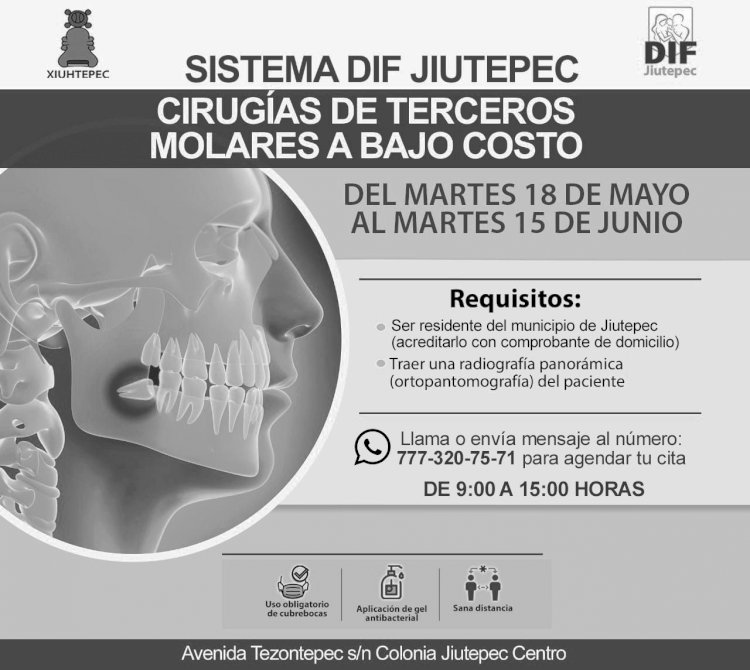 En Jiutepec se pueden extraer muelas del juicio a bajo costo