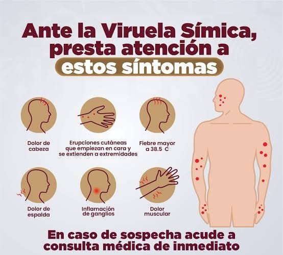 Confirman 2 contagios más de viruela símica en Morelos
