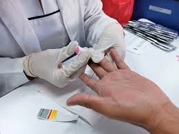 Realiza la FDyCS de la UAEM pruebas rápidas de VIH y sífilis